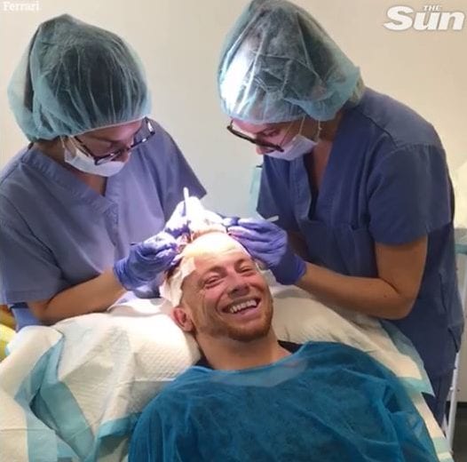 Joe Swash undergoes 3rd hair transplant at KSL