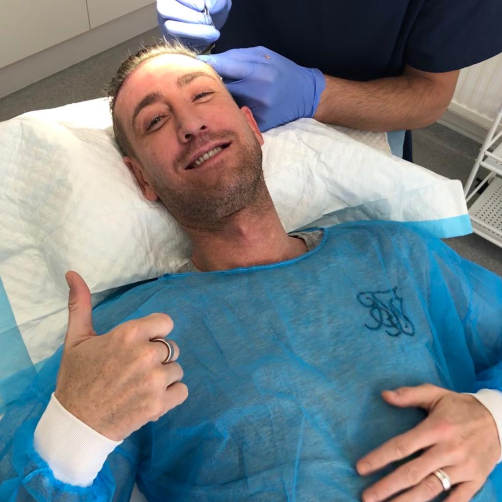 Christopher Maloney visits KSL Clinic for his corrective FUE Hair Transplant procedure