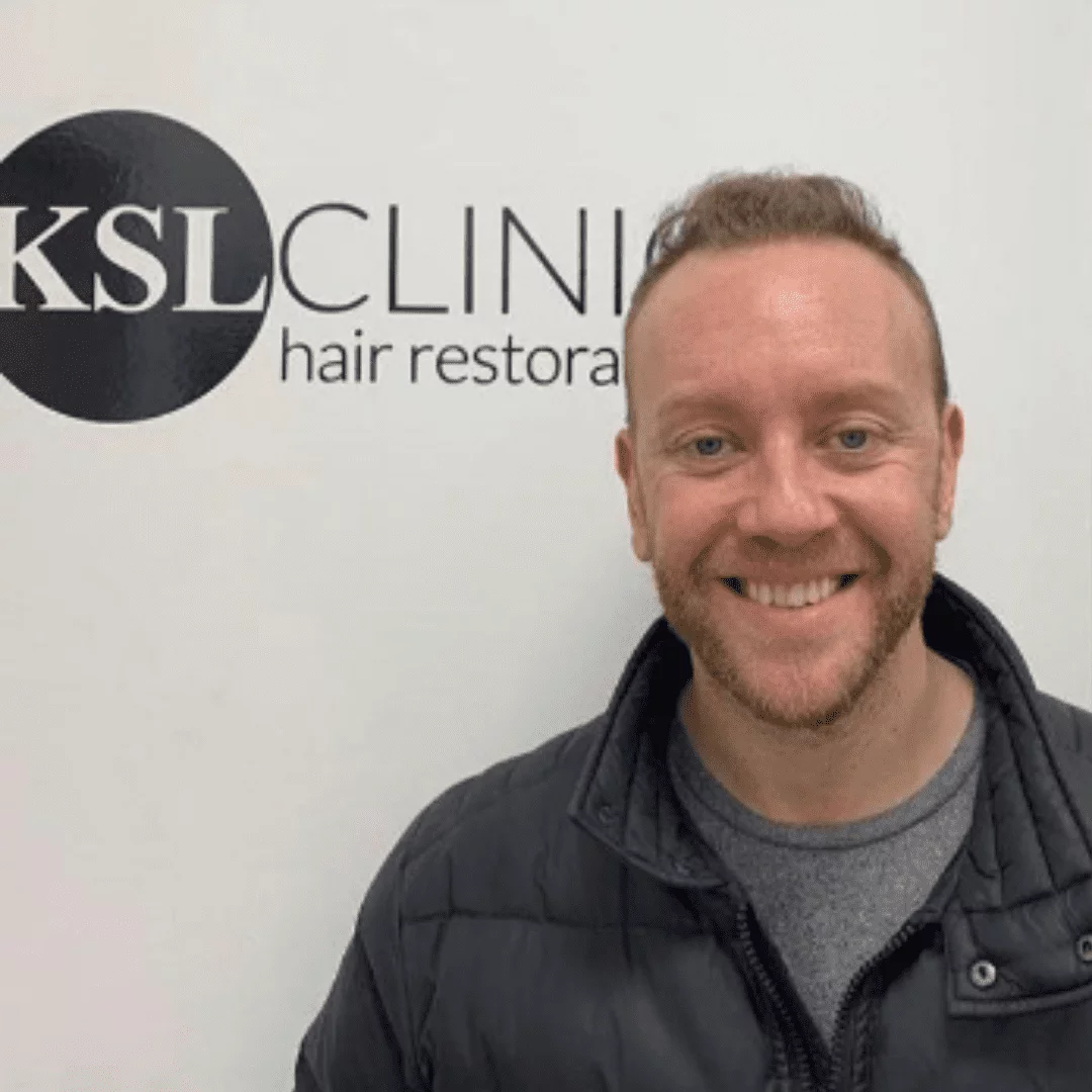 KSL hair transplant