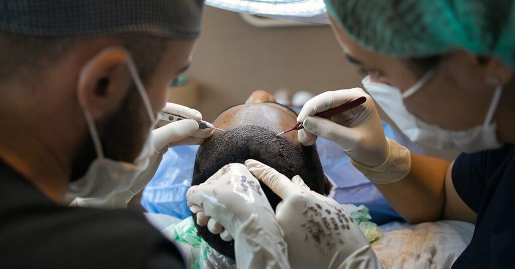 Patient undergoing surgery if is Hair Transplant Painful