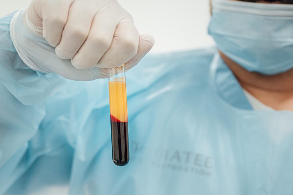 is PRP worth it?